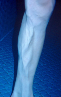 Aquatraining, Aquatherapie, Massagewirkung Wade Übung Ansohlen, Therapie bei Margot Zeitvogel-Schönthier Aquatraining, Aquatherapie, Massagewirkung Wade Übung Ansohlen, Therapie bei Margot Zeitvogel-Schönthier